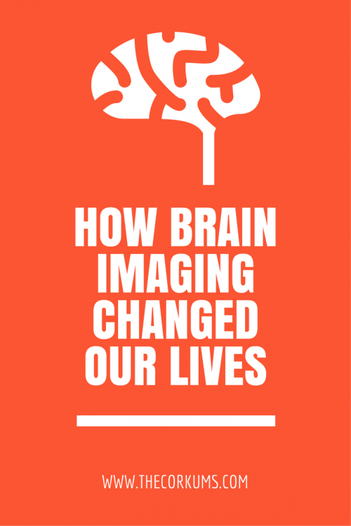 brain imaging